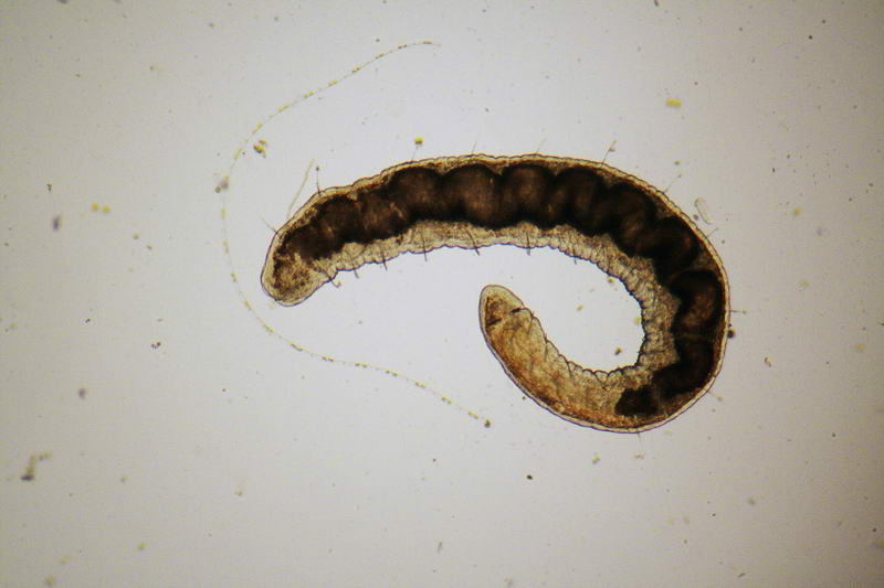 oligochete (Stylaria sp???) - immagini