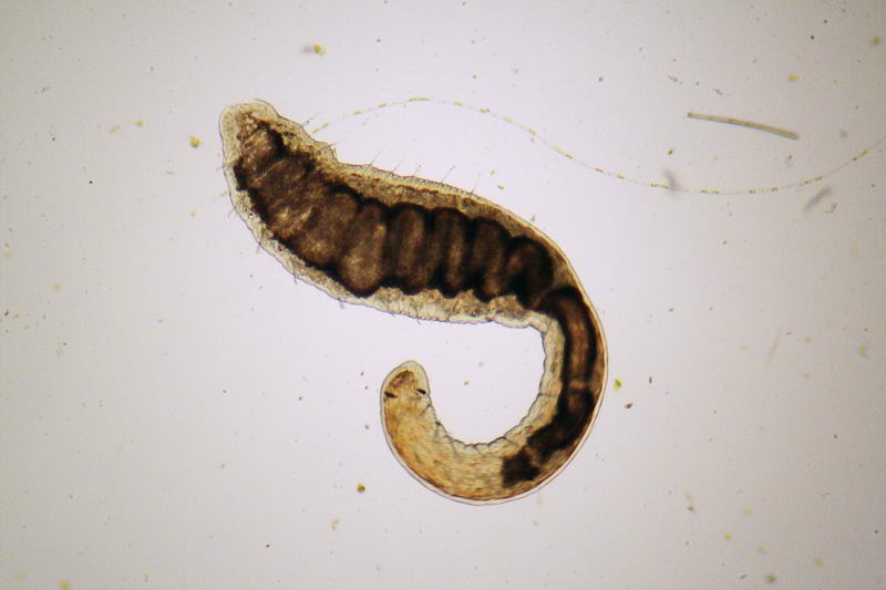 oligochete (Stylaria sp???) - immagini