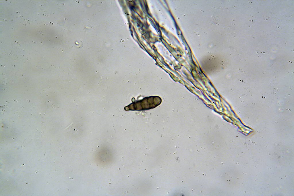 Curiosa mazzetta, forse conidioforo fungino