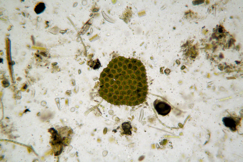 Pediastrum