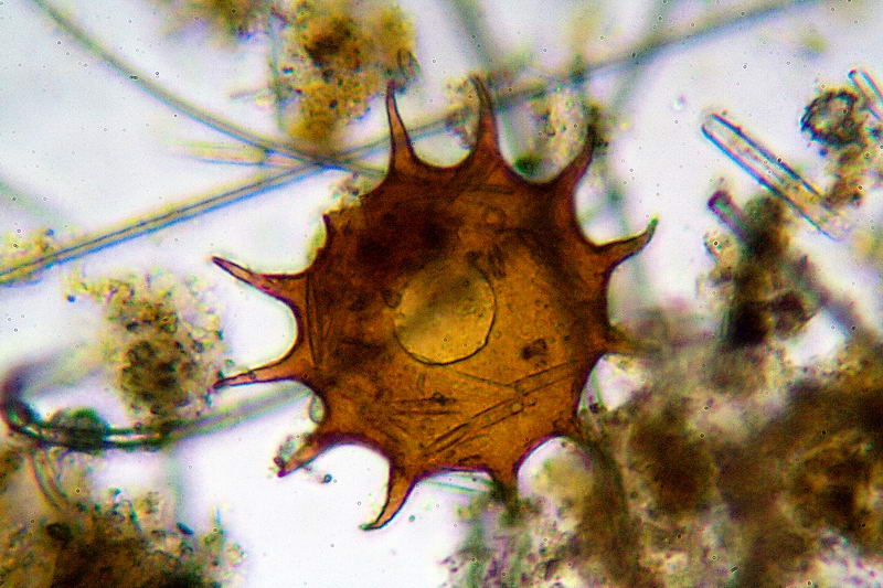 Tecameba (Arcella dentata)
