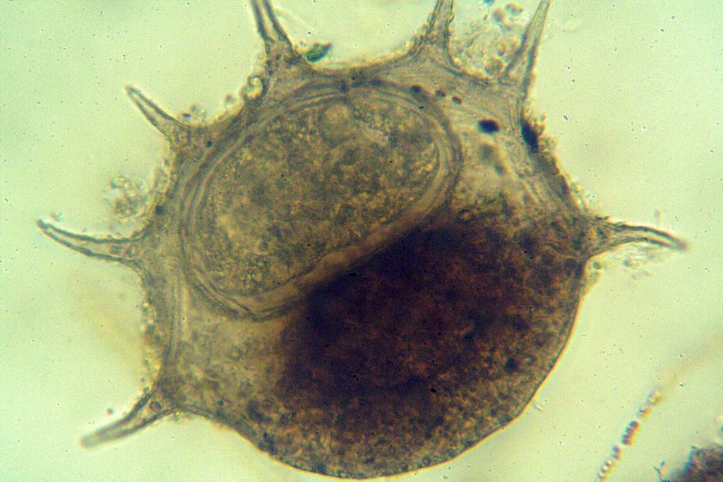 ancora Centropyxis