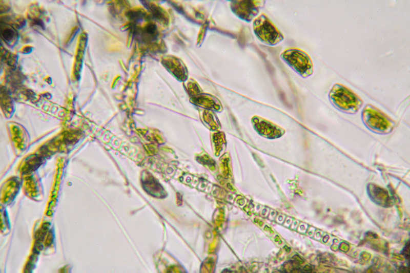 encyonema (1)