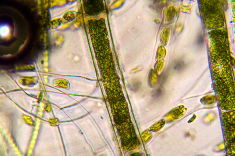 encyonema (1)