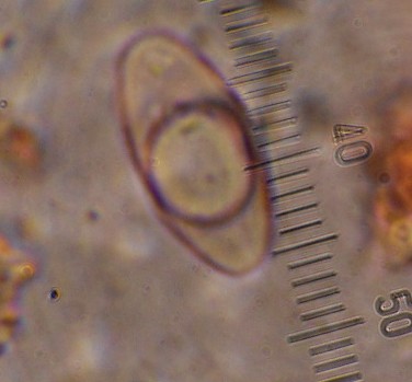 Porpidia ?