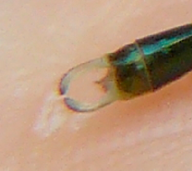 Chalcolestes viridis?    no, Chalcolestes parvidens