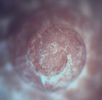 O. aciculata aciculata ?