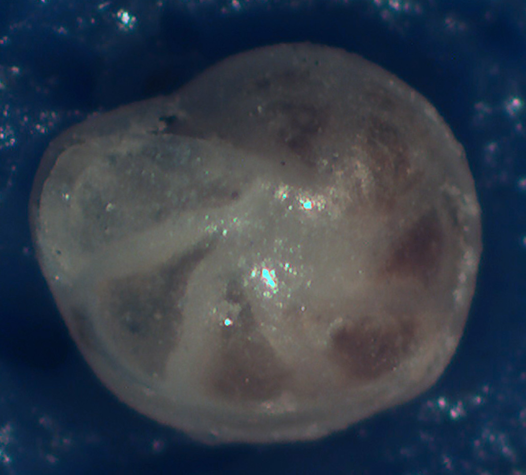 Foraminifero da identificare