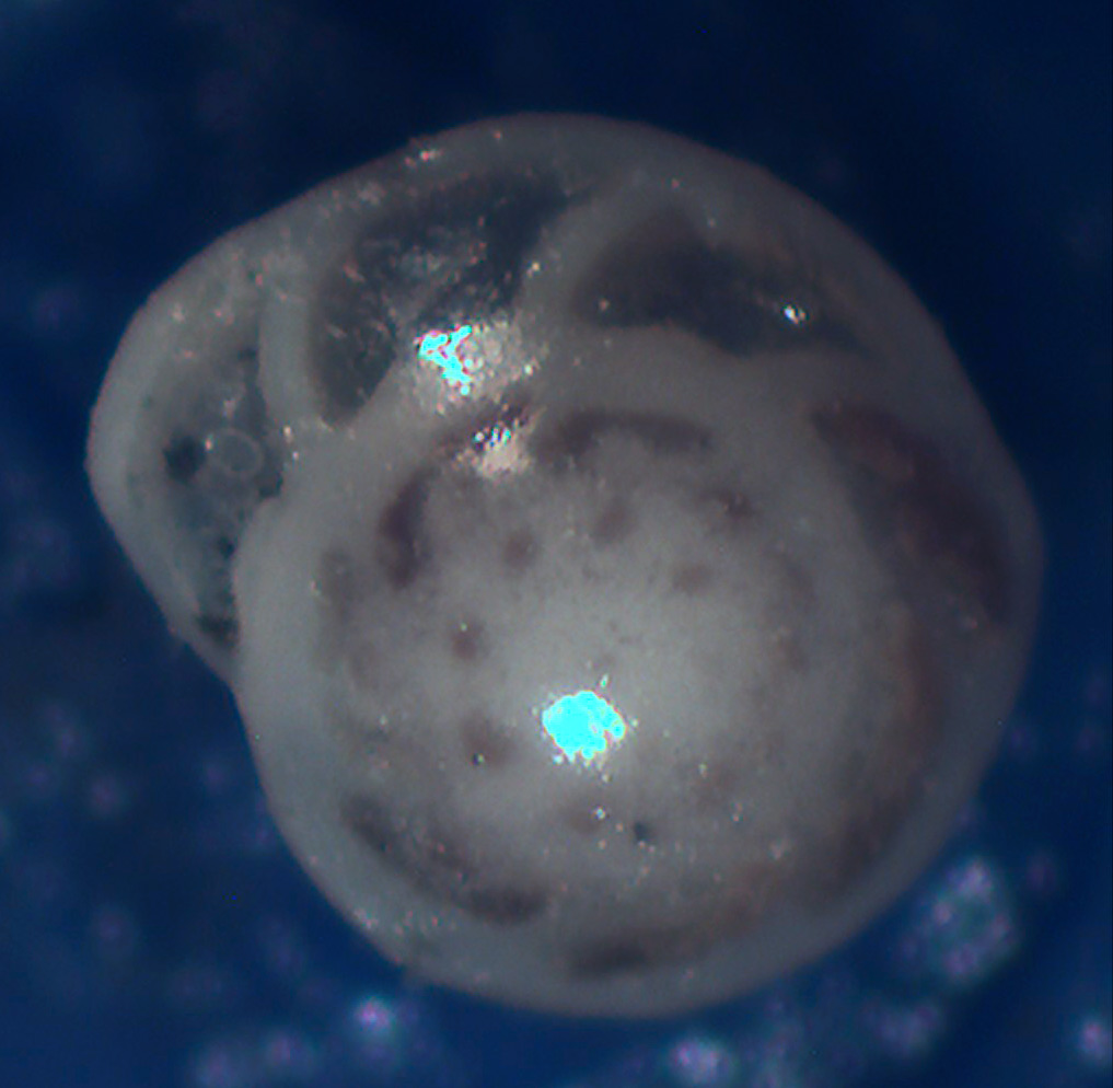 Foraminifero da identificare