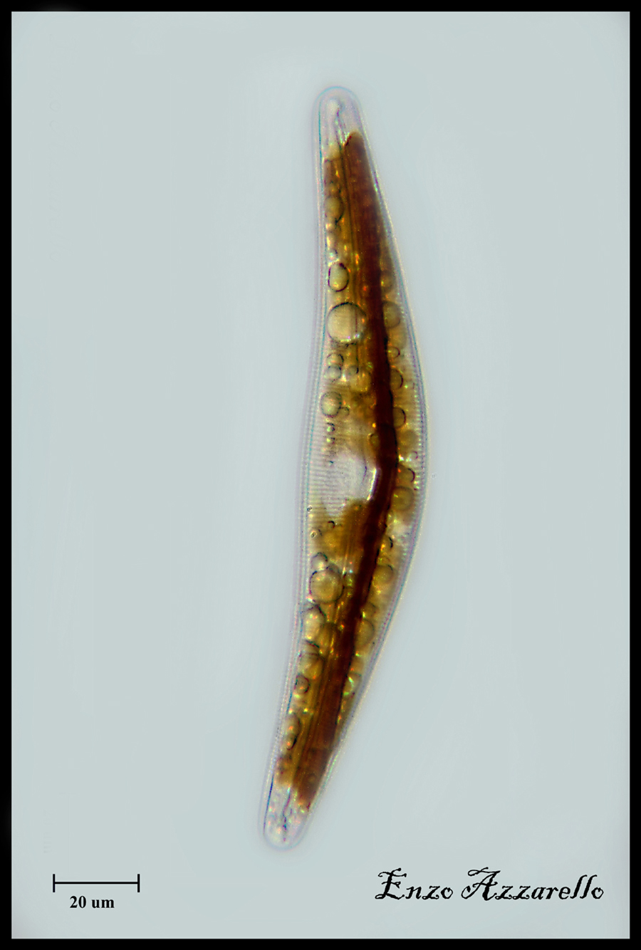 Cymbella
