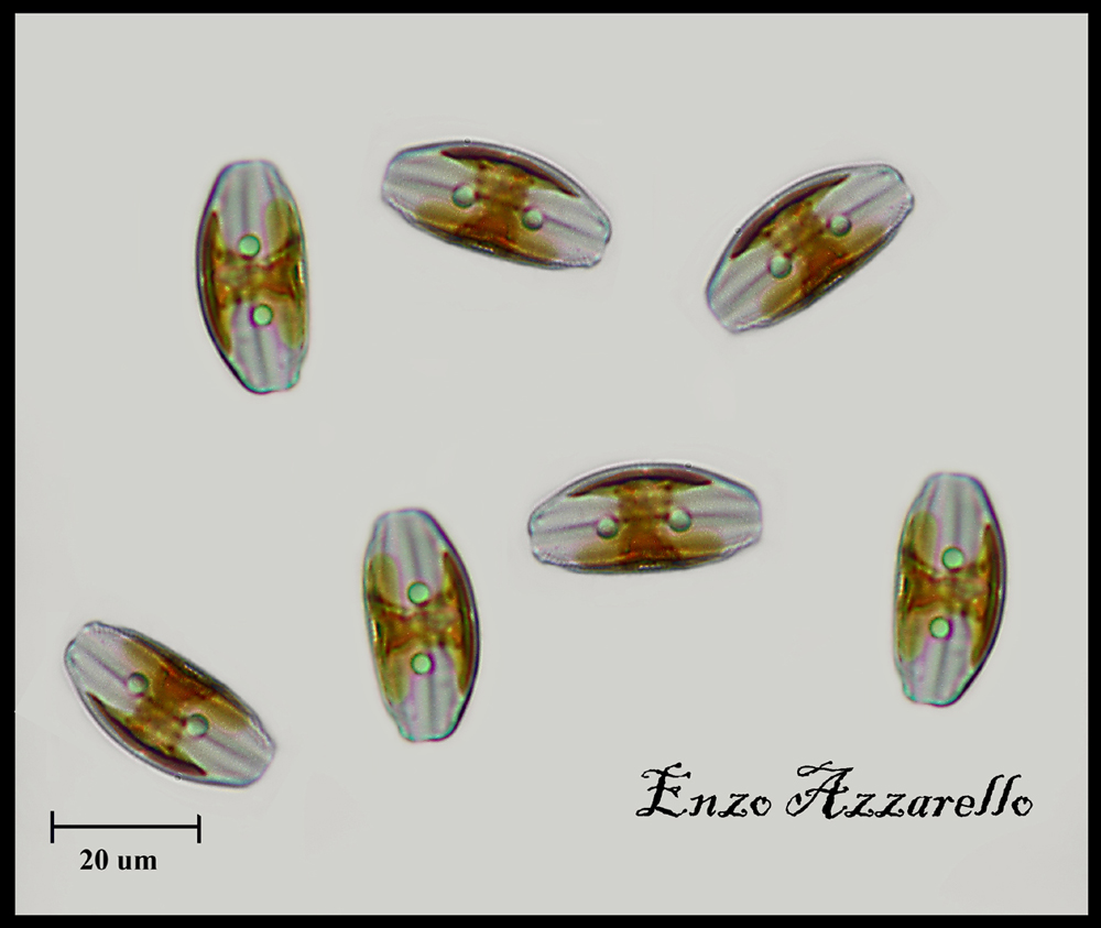 Amphora ovalis