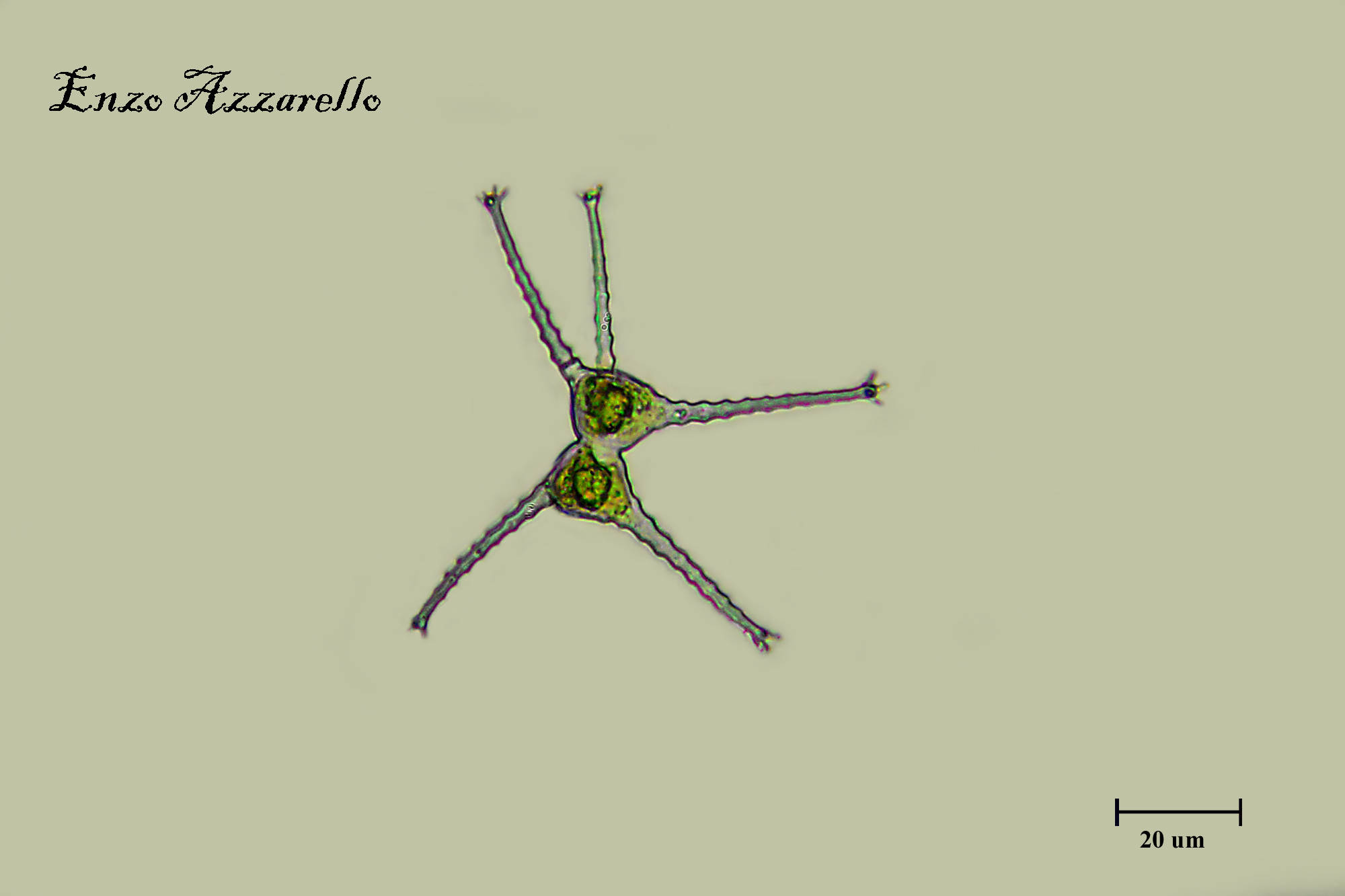 Staurastrum sp
