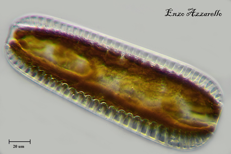 Suriella ob 40X