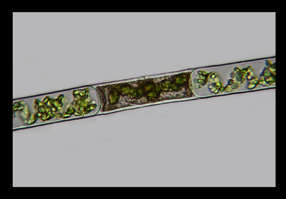 Che alga �? Una particolare specie di Spirogyra?