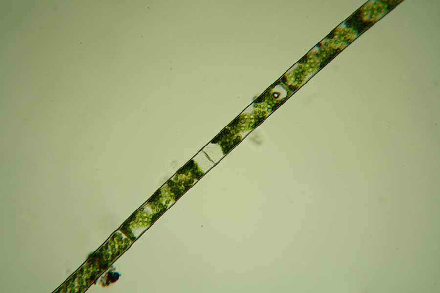 Spirogyra