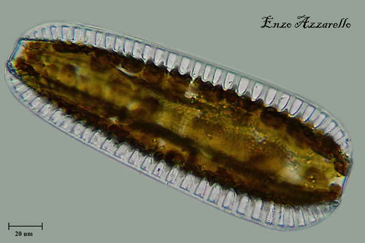 Suriella ob 40X