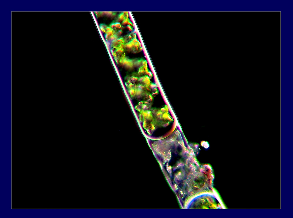 Che alga �? Una particolare specie di Spirogyra?