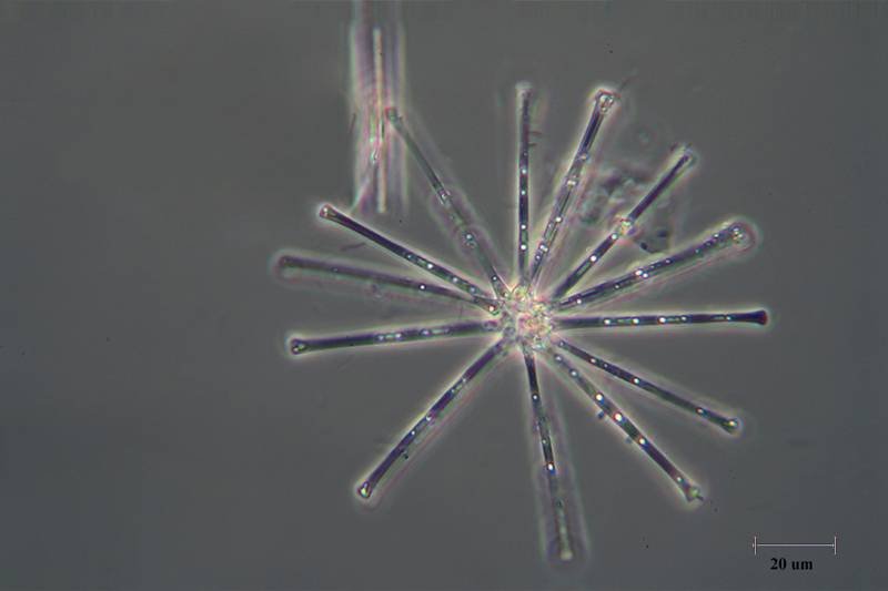 Asterionella