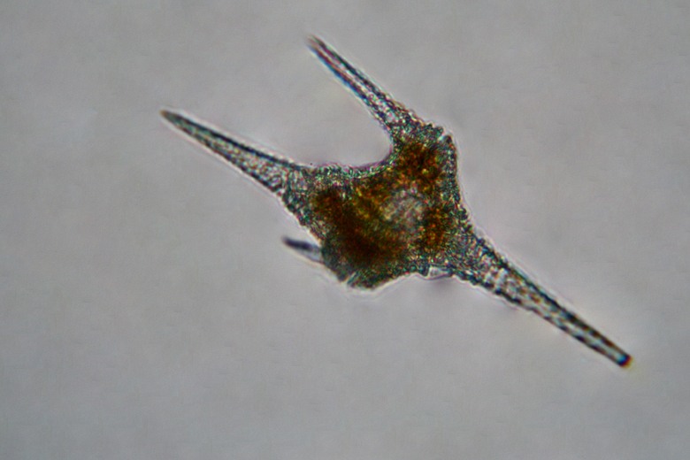 Aiuto identificazione microrganismi