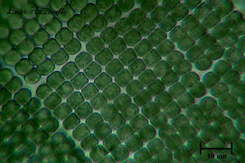 Merismopedia - campo scuro - Rheinberg - campo chiaro