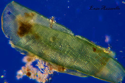 Merismopedia - campo scuro - Rheinberg - campo chiaro