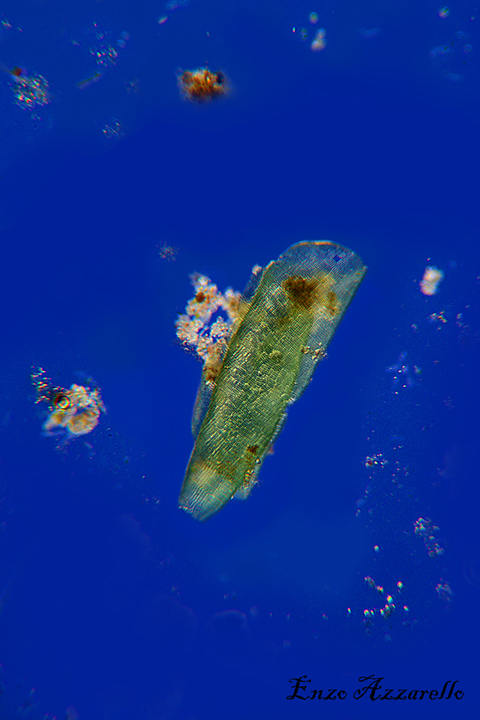 Merismopedia - campo scuro - Rheinberg - campo chiaro