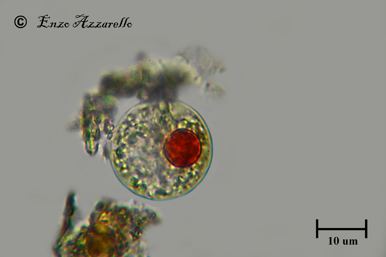Haematococcus pluvialis 1000X IMMERSIONE E DOPPIA IMMERSIONE