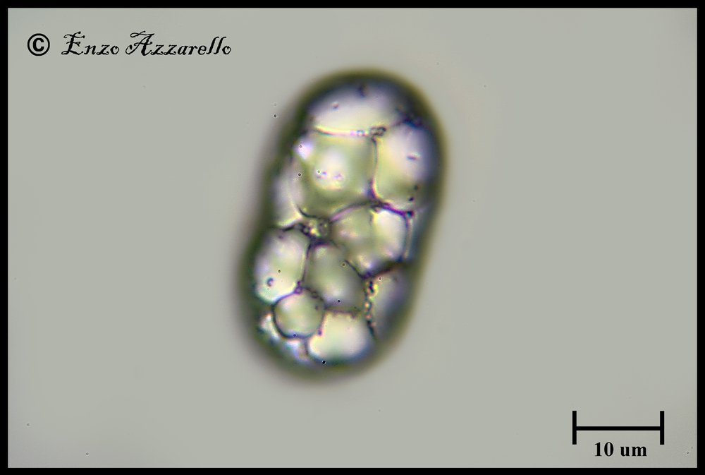 Microrganismo da identificare 1000X