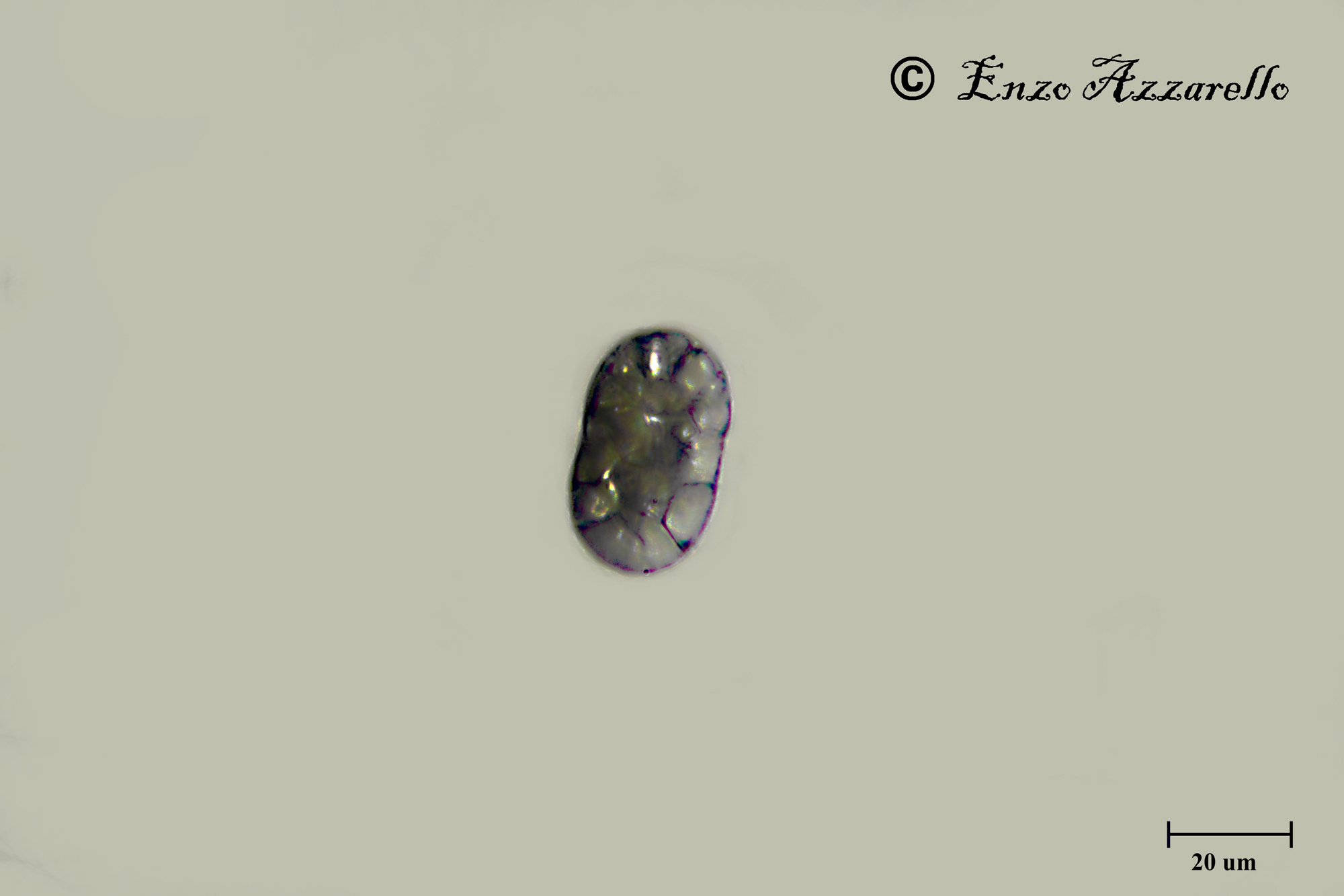 Microrganismo da identificare 1000X