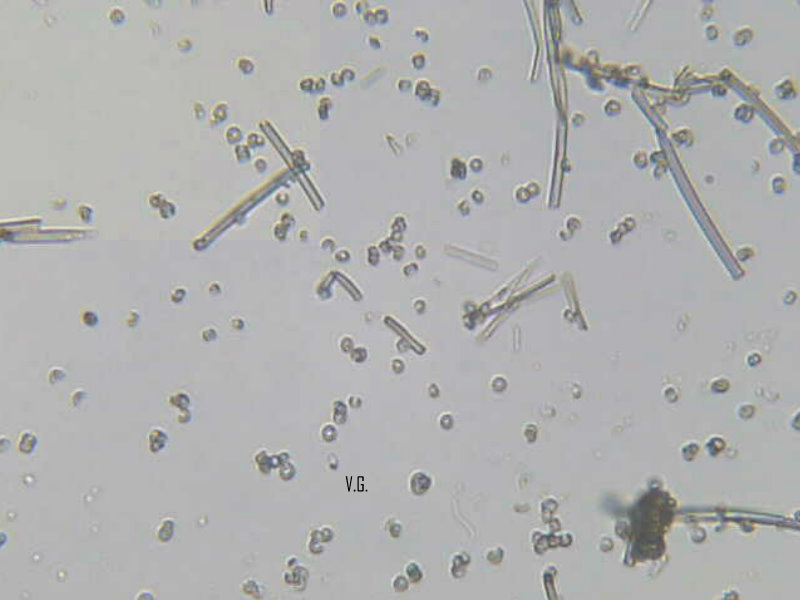 Cocciniglia del limone?