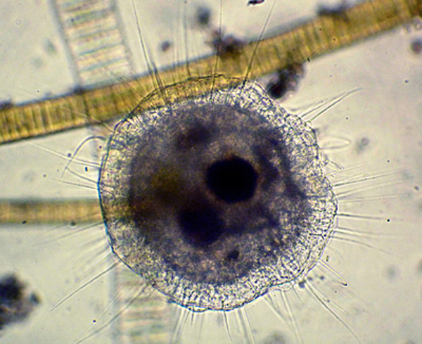 Actinosphaerium eichhorni