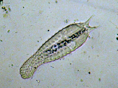 GASTROTRICHI