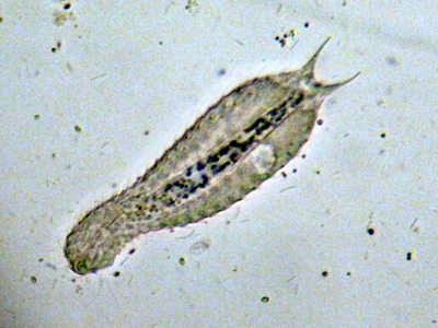 GASTROTRICHI