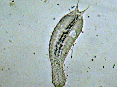 GASTROTRICHI