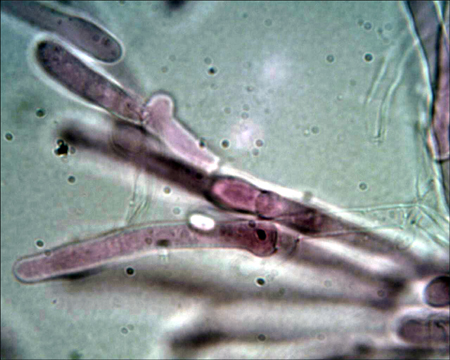 Trechispora mollusca ? (Trechispora mollusca)