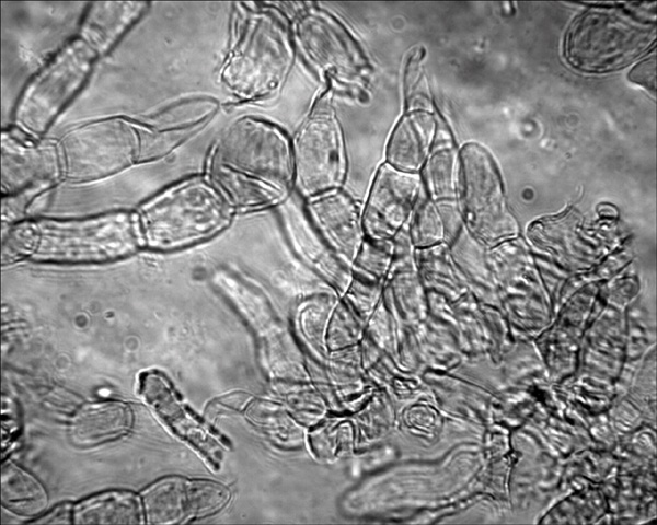 Xerocomus da determinare