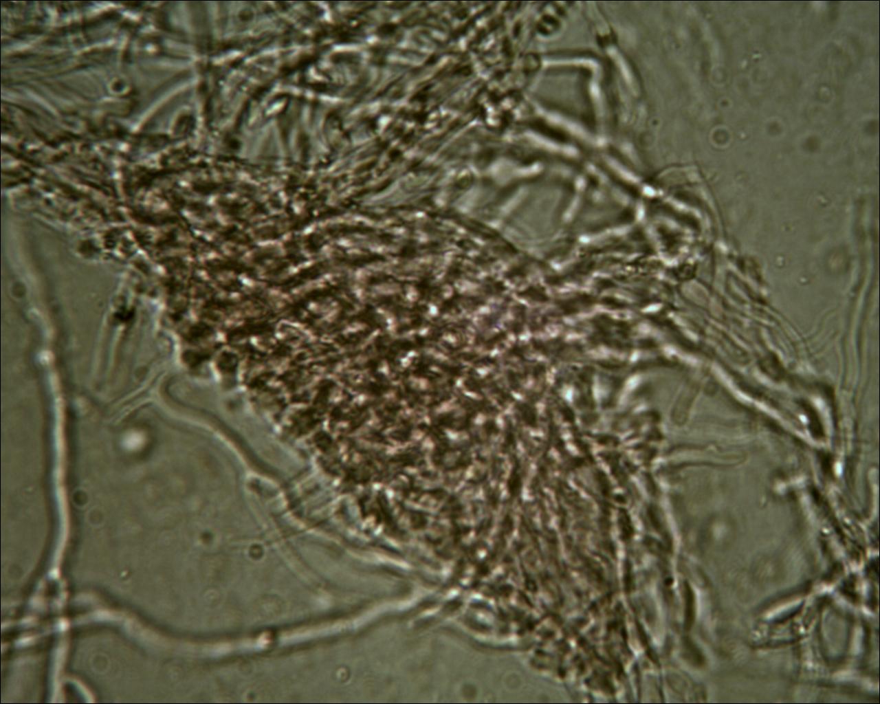 Chiedo aiuto (Byssomerulius corium)