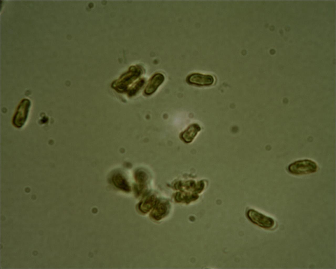 Chiedo aiuto (Byssomerulius corium)