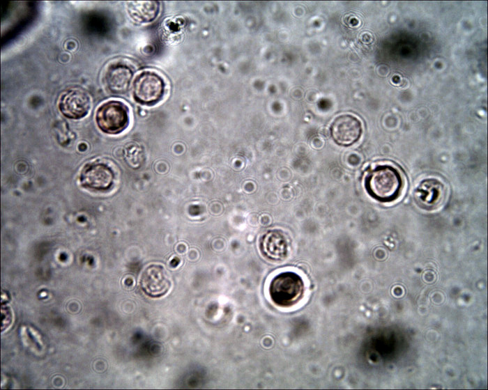 Quiz: foresta di funghi.