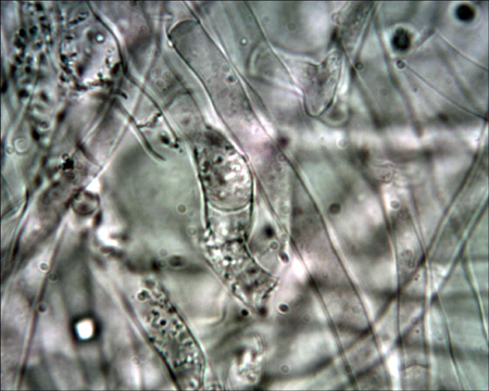 Trechispora mollusca ? (Trechispora mollusca)