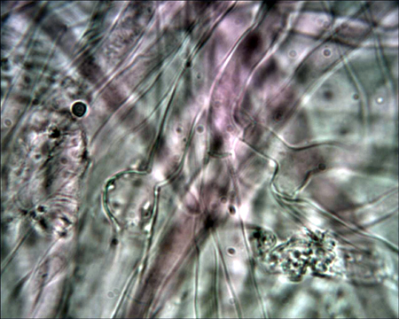 Trechispora mollusca ? (Trechispora mollusca)