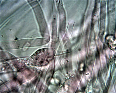 Trechispora mollusca ? (Trechispora mollusca)