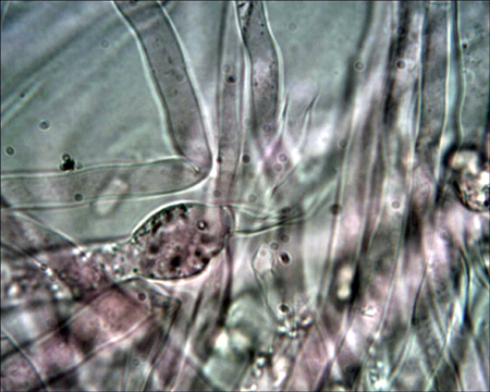 Trechispora mollusca ? (Trechispora mollusca)