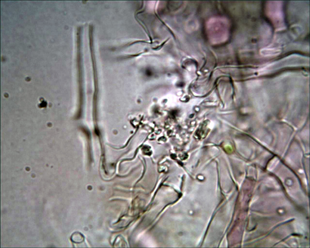 Trechispora mollusca ? (Trechispora mollusca)