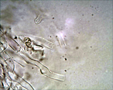 Trechispora mollusca ? (Trechispora mollusca)