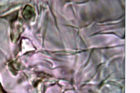 Trechispora mollusca ? (Trechispora mollusca)