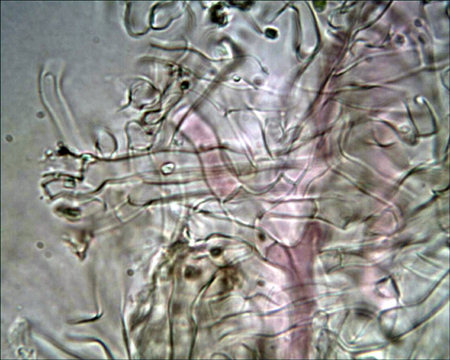Trechispora mollusca ? (Trechispora mollusca)