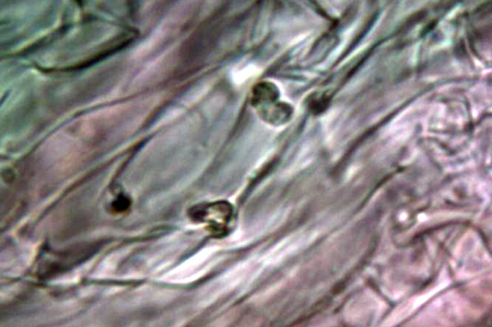 Trechispora mollusca ? (Trechispora mollusca)