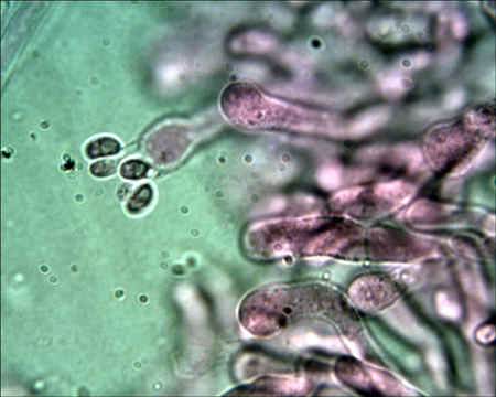 Trechispora mollusca ? (Trechispora mollusca)
