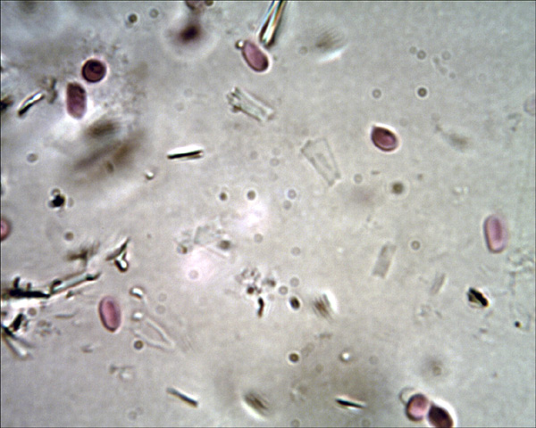 Ancora Schizopora paradoxa? (Schizopora paradoxa)